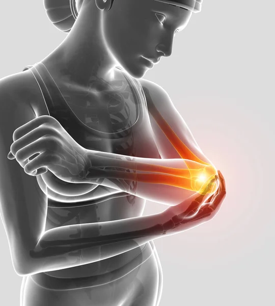 3D illüstrasyon kadın duygu dirsek ağrısı — Stok fotoğraf