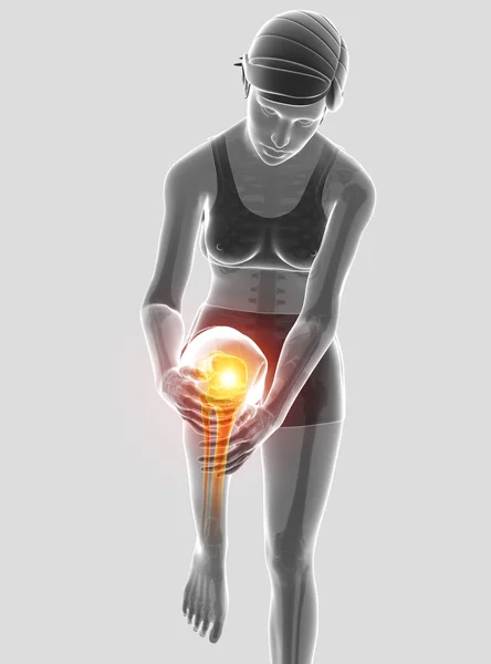 Ilustración 3d de las mujeres sintiendo dolor de rodilla — Foto de Stock