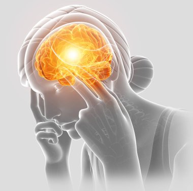 baş ağrısı hissediyor kadın 3D çizimi