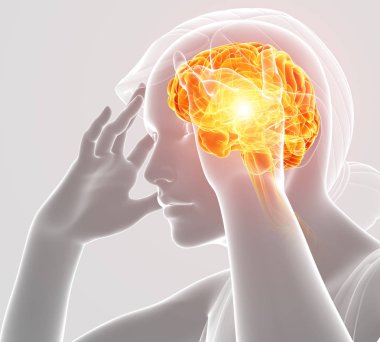 baş ağrısı hissediyor kadın 3D çizimi