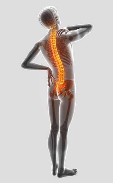 3D απεικόνιση του αρσενικού που αισθάνονται τον πόνο στην πλάτη — Φωτογραφία Αρχείου