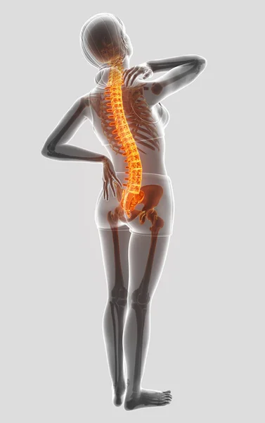 3d 插图的女性感觉背部疼痛 — 图库照片
