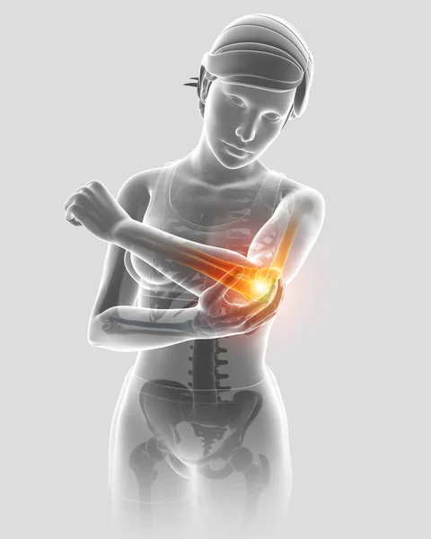 3D απεικόνιση των γυναικών συναίσθημα αγκώνα πόνος — Φωτογραφία Αρχείου