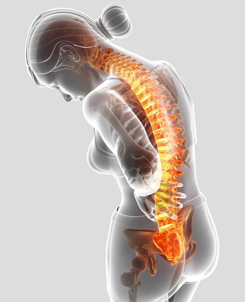Ilustração 3D da fêmea sentindo a dor nas costas — Fotografia de Stock