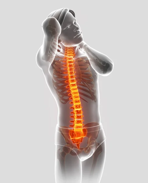 3D-Illustration des Mannes, der Rückenschmerzen spürt — Stockfoto
