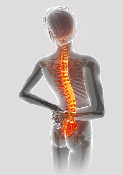 3D Illustration of male Feeling the back pain — Stock Photo, Image