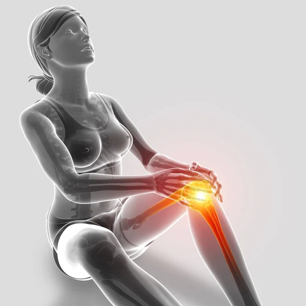 Ilustración 3d de las mujeres sintiendo dolor de rodilla — Foto de Stock