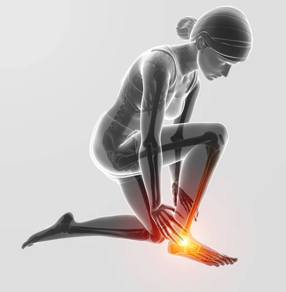 3D obrázek ženské nohy s bolestí kotníku — Stock fotografie