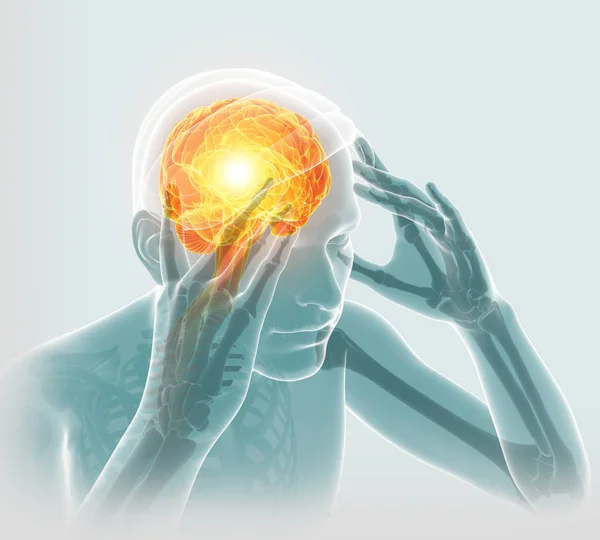 3D-s illusztráció férfi érzés fejfájás — Stock Fotó