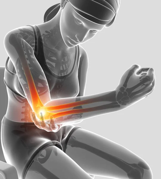 3d ilustração de mulheres sentindo dor no cotovelo — Fotografia de Stock