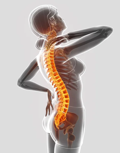 3D Illustration of Female Feeling the back pain — Stock Photo, Image