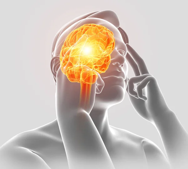3D illustration av manliga känsla huvudvärk — Stockfoto