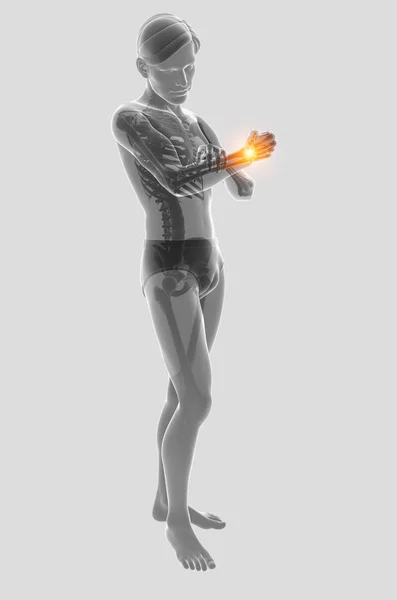 3D illustration av manliga känsla armbågen smärta — Stockfoto