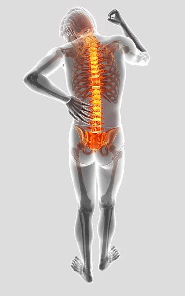 Ilustração 3D do macho Sentir a dor nas costas — Fotografia de Stock