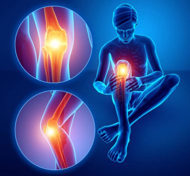 3D çizim, diz ağrısı duygu erkek