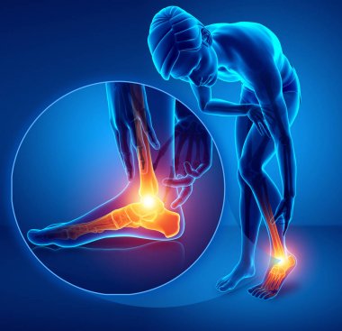 3d illustration of male foot with ankle pain clipart
