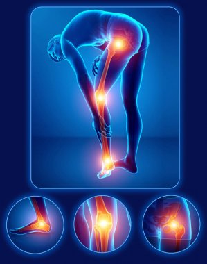 erkek duygu bacak ağrısı 3D çizimi