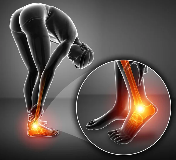 3d illustration of male foot with ankle pain