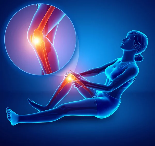 3D ilustracja z kobieta czuje ból kolana — Zdjęcie stockowe