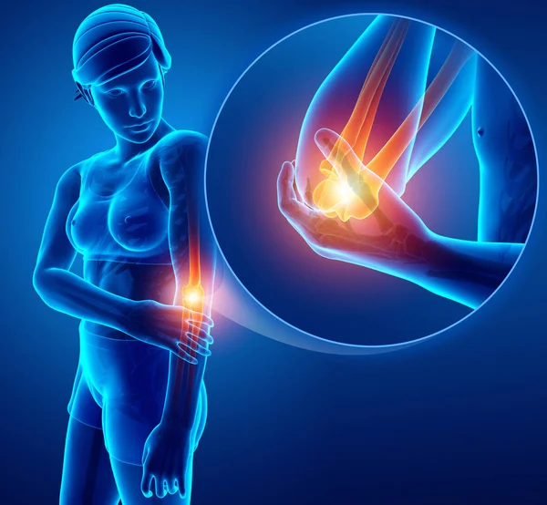 3d Illustration of Women Feeling Elbow pain — Stock Photo, Image