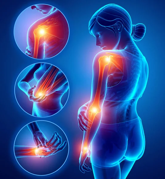 3D Illustration des weiblichen Empfindens von Armgelenkschmerzen — Stockfoto