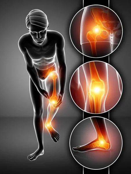 3D ilustracja mężczyzna uczucie ból nóg — Zdjęcie stockowe
