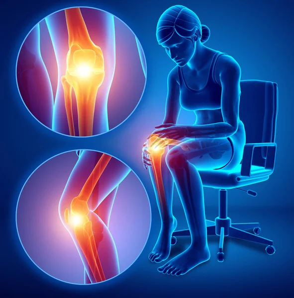 3d Illustration of Female feeling Knee pain