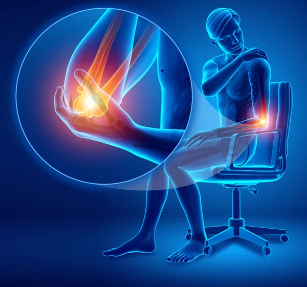 3d Illustration of Male Feeling Elbow pain — Stock Photo, Image