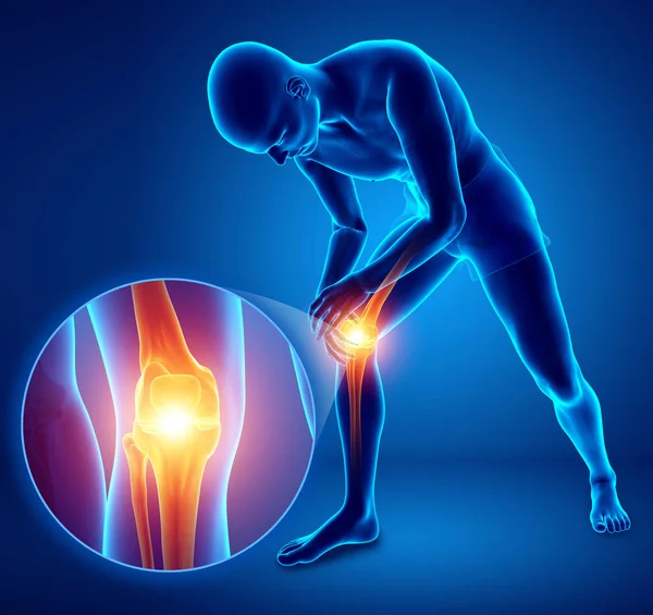 3d Illustration of Male feeling Knee pain — Stock Photo, Image