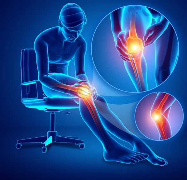 3d Illustration of Male feeling Knee pain