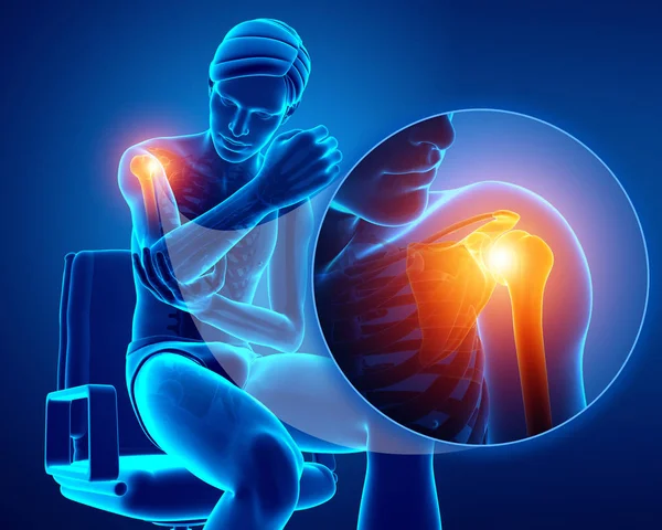 3D illustratie van mannelijke gevoel van de pijn in de schouder — Stockfoto