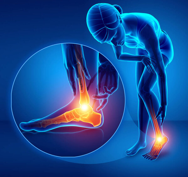 3d иллюстрация женской ноги с болью в лодыжке
