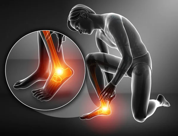 3d illustration of male foot with ankle pain