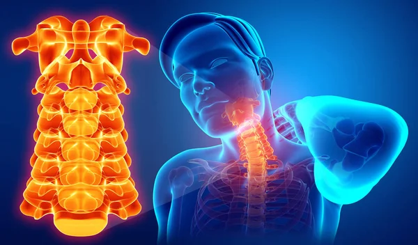 3d Illustration of male Feeling the Neck Pain — Stock Photo, Image