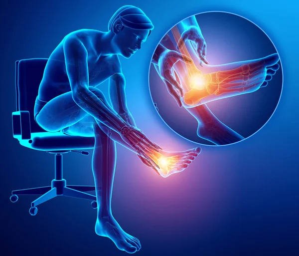 Ilustración 3d del pie masculino con dolor en el tobillo — Foto de Stock
