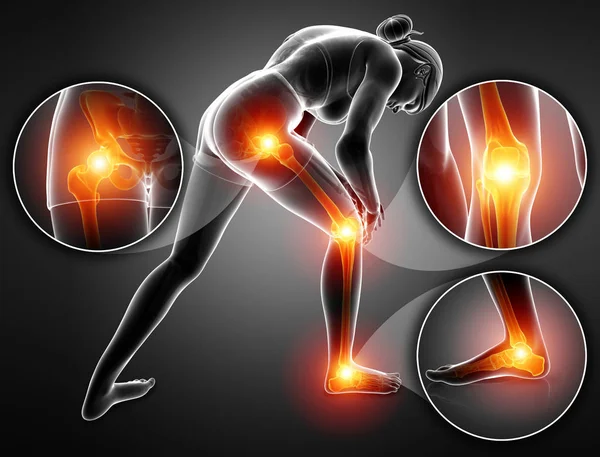3D ilustracja z kobieta czuje ból nóg — Zdjęcie stockowe