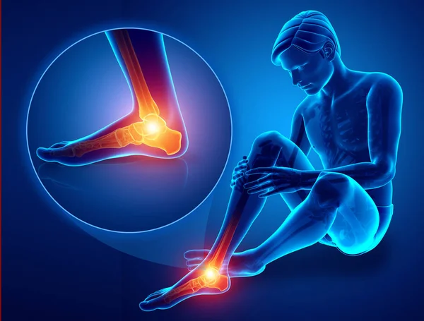 3d Illustrazione del piede maschile con dolore alla caviglia — Foto Stock