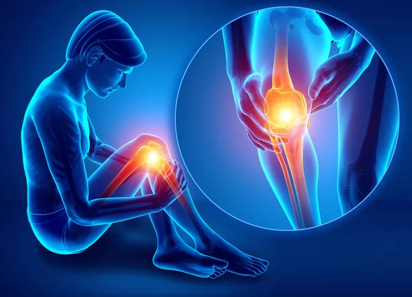 3d Illustration of Male feeling Knee pain