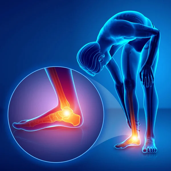 3D ilustracja mężczyzna stóp z bólem w kostce — Zdjęcie stockowe