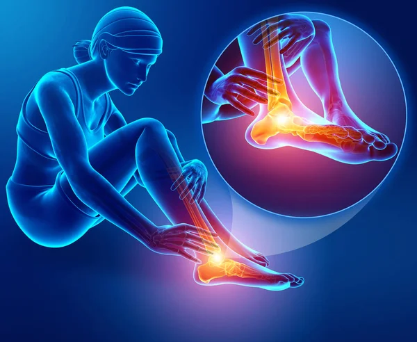 Ilustração 3d do pé feminino com dor no tornozelo — Fotografia de Stock