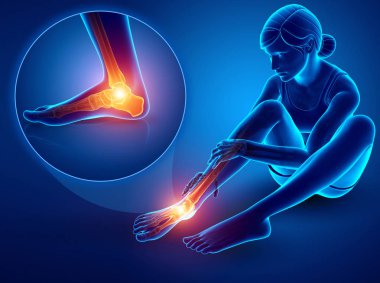 3d illustration of Female foot with ankle pain clipart