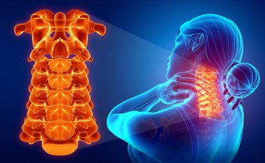 Boyun ağrısı duygu erkek 3D çizimi
