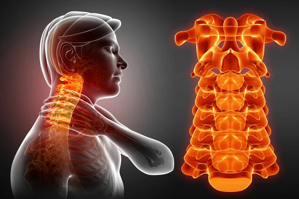 3d Illustration of male Feeling the Neck Pain — Stock Photo, Image