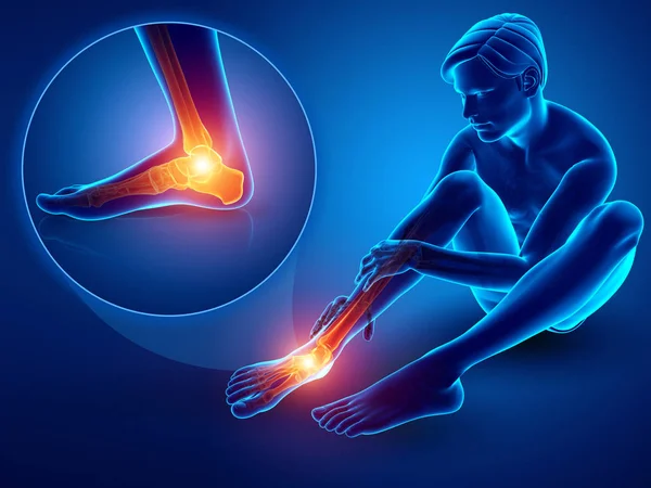 3D çizim erkek ayak ayak bileği ağrısı ile — Stok fotoğraf