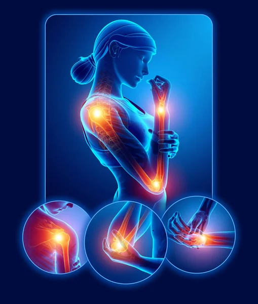 Ilustração 3D da dor nas articulações do braço de sensação feminina — Fotografia de Stock
