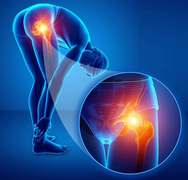 3D illustratie van mannelijke met Hip pain — Stockfoto