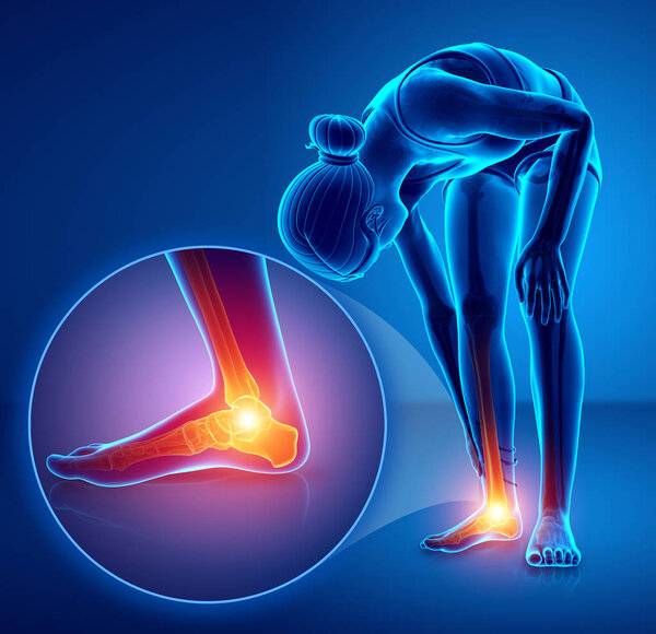 3d иллюстрация женской ноги с болью в лодыжке

