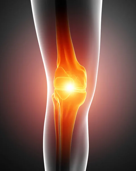 3d Illustrazione della sensazione maschile Dolore al ginocchio — Foto Stock