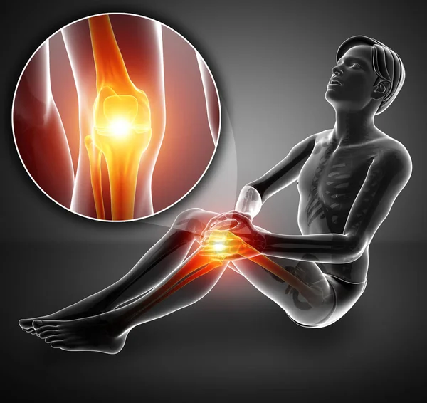 3d Иллюстрация мужского чувства боли в коленях — стоковое фото