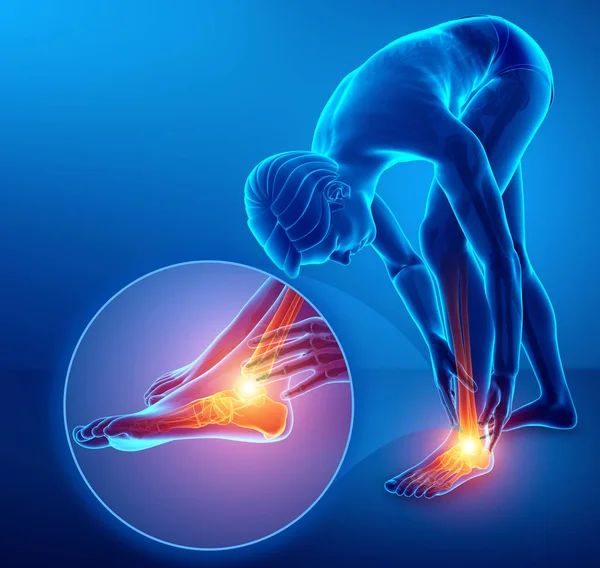 3d illustration of male foot with ankle pain — Stock Photo, Image